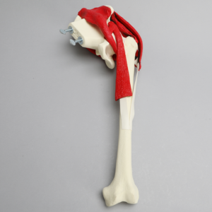 Hemi Pelvis with Erosion, Muscles, and Torn Labrum