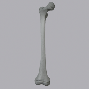 Femur, Pediatric with Radiopaque, Right