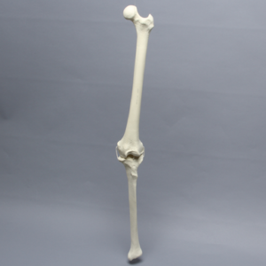 Knee with Four Non-Stretch Ligaments, Full Length, Arthritic