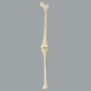 Knee with Three Nylon Non-Stretch Ligaments and Narrow Intercondylar Notch, Full Length