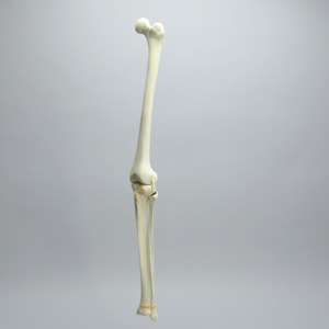 Knee with Unicondylar Fracture and Collateral Ligaments, Full Length