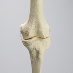 Knee Replacement for Hip Assembly #1301-160