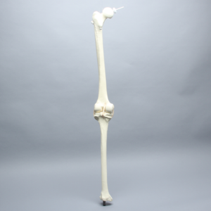 Knee Replacement for Hip Assembly #1301-161