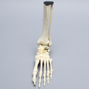Foot and Ankle with Wall and Neck Fractures of Calcaneus and Talus