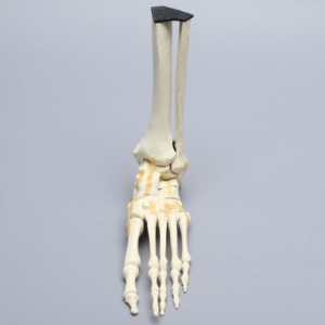 Foot and Ankle with Lisfranc and Cuboid Fractures