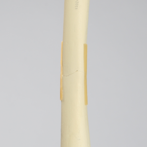 Femur with Transverse Fracture, Foam Cortical, Left, Small
