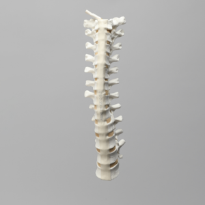 Spine, Thoracic, Solid Foam