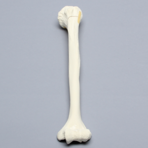 Humerus with Neck Fracture, Foam Cortical