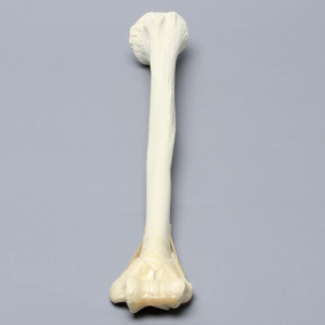 Humerus with "Y" Fracture and Periosteum, Foam Cortical