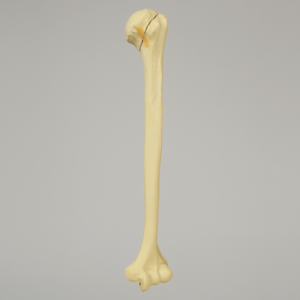Humerus with Three-Part Head Fracture, Foam Cortical