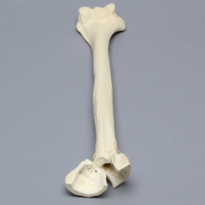 Humerus with Fractures and Suture Holes, Foam Cortical