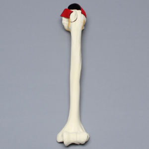 Humerus with Five-Part Head Fracture and Ligaments, Foam Cortical