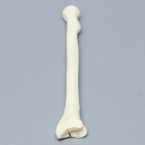 Radius with Four-Part Fracture, Foam Cortical