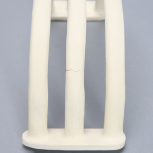 Rib Set with Fracture for IM Nail, Solid Foam