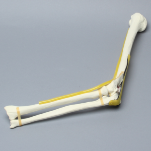 Elbow with Six-Part Fracture, Nerve, and Tendon, Foam Cortical