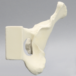 Hemi Pelvis with Segmental Defects, Solid Foam, Left