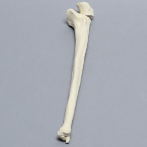 Ulna with Olecranon Fracture, Solid Foam