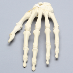 Hand with Scaphoid Fracture and Articulated Metacarpal, Solid Foam