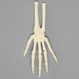 Hand and Wrist, Pediatric, Solid Foam