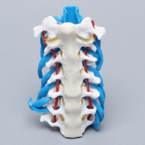Cervical Spine with Dura and Nerve Roots