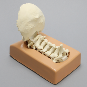 Spine Holder, Posterior C1-C7