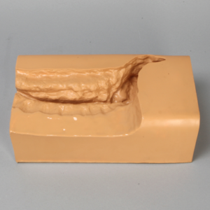 Spine Holder, Lateral L1-Sacrum