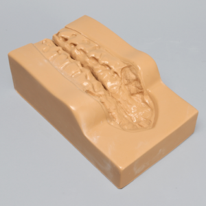 Lumbar Holder for Anterior Approach, Without Muscle Structure