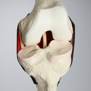 Knee Insert for #1413-20