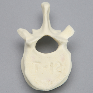 Vertebra, T12, Foam Cortical