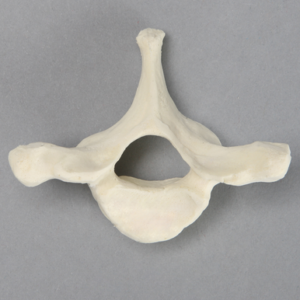 Vertebra, T1, Foam Cortical