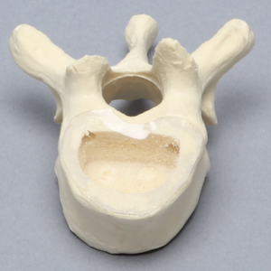 Vertebra, T10, Clear Window, Foam Cortical