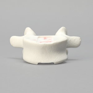Vertebra, L5, Foam Cortical Shell, For Spinal Navigation
