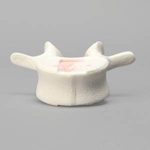 Vertebra, L4, Foam Cortical Shell, For Spinal Navigation