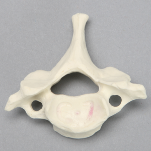 Vertebra, C7, Foam Cortical