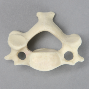 Vertebra, C3, Foam Cortical