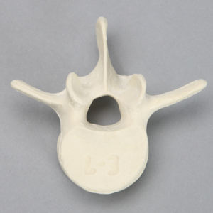 Vertebra, L3, Solid Foam