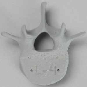 Vertebra, L4, Radiopaque