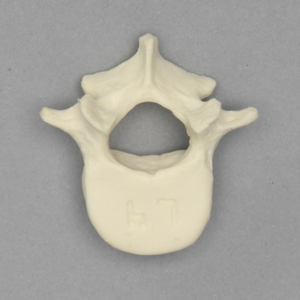 Vertebra, L4, Pediatric, Solid Foam
