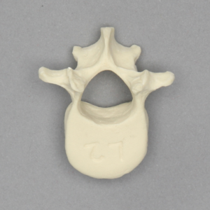 Vertebra, L2, Pediatric, Solid Foam