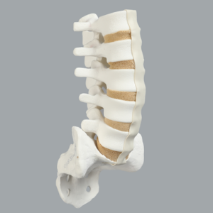 Spine, Lumbar, L1-Sacrum, Foam Cortical Shell