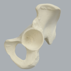 Hemi Pelvis with 56 mm Acetabulum and Vise Attachment, Solid Foam, Left