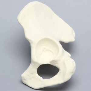 Hemi Pelvis with 52 mm Acetabulum, Left
