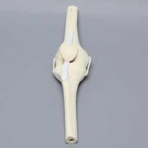 Knee Joint with Patella and Four Non-Stretch Ligaments, Solid Foam, Right, Medium